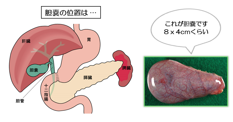 胆嚢